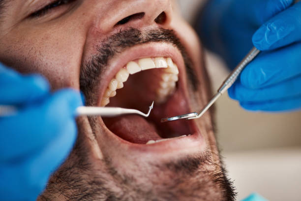 Best Dental Fillings (Composite and Amalgam)  in Bridgeport, CT